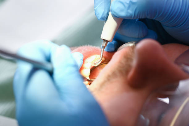 Best Emergency Treatment for Jaw Pain or Injury in Shillington, PA